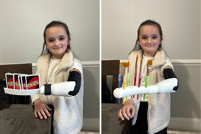 Niña usa prótesis impresa en 3D para jugar cartas y pintar, cosas tan curiosas como maravillosas.