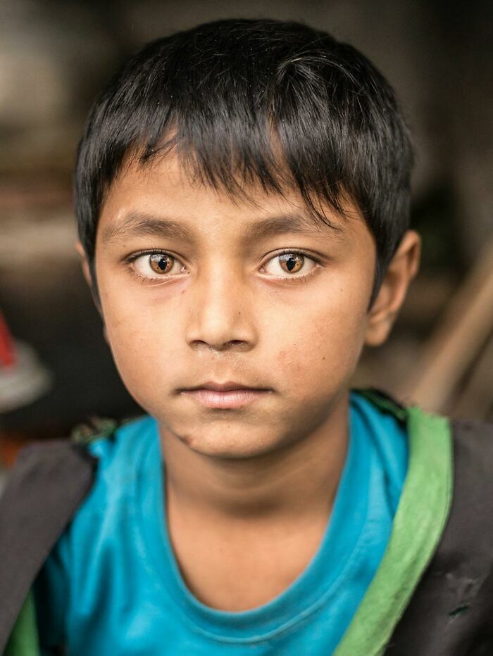 Retrato de un niño con ojos de tonalidades únicas, entre las cosas tan curiosas compartidas