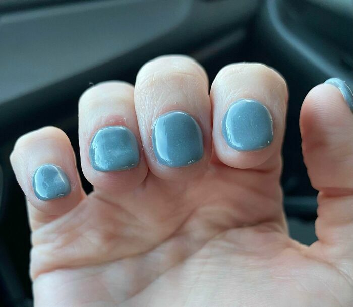 Un trabajo de manicura mal hecho en un salon de belleza con esmalte azul grueso y deforme.