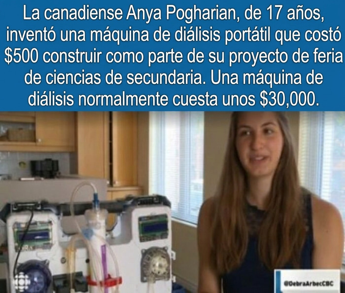 Anya Pogharian con su máquina de diálisis de bajo costo, uno de los datos curiosos de ciencia