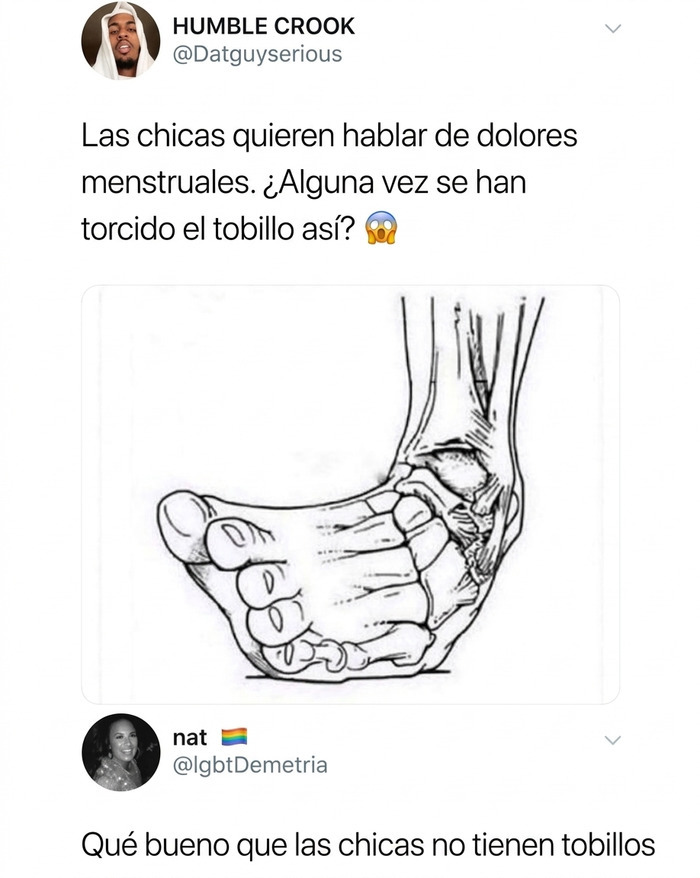 Publicación de Twitter con comentarios más graciosos sobre la ilustración de un tobillo torcido.