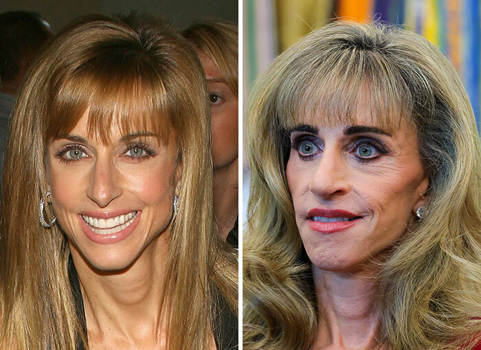 Transformaciones faciales extremas en mujeres del círculo de Trump