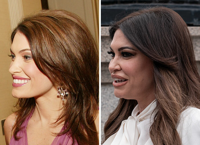 Mujeres del círculo de Trump con cambios faciales discutidos públicamente