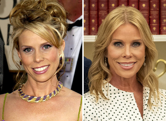 Evolución facial de mujer de círculo Trump y controversia de la cara MAGA