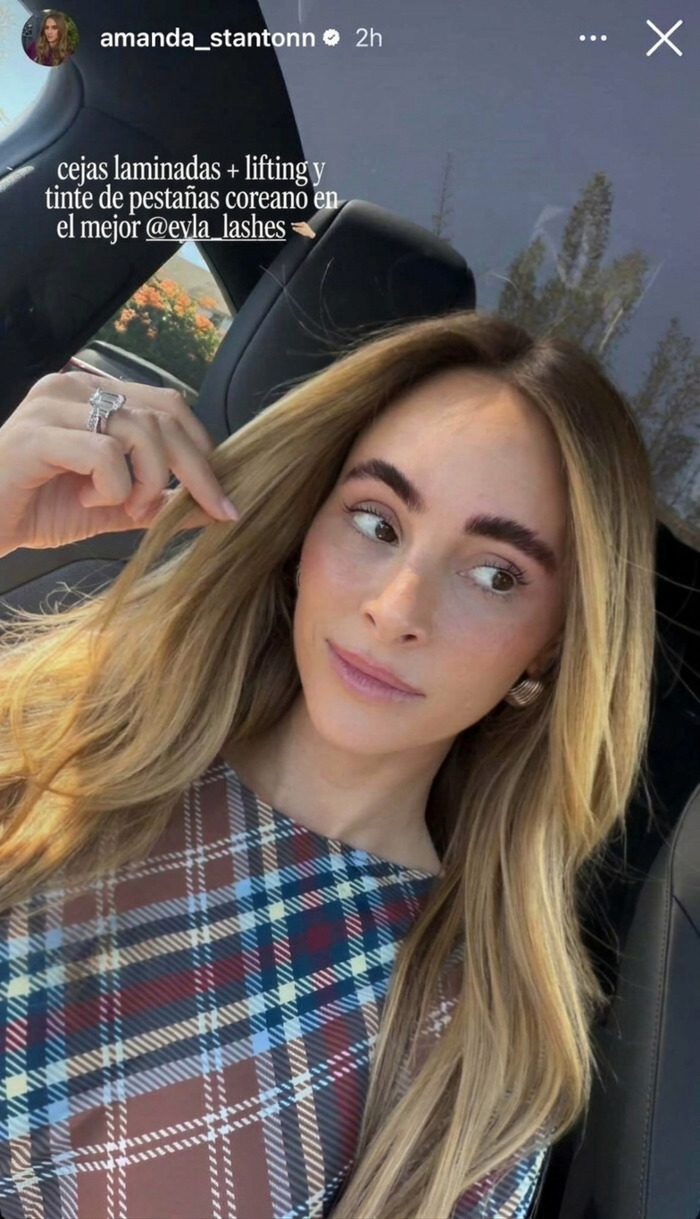 Influencers haciendo el ridículo presumiendo sus tratamientos estéticos