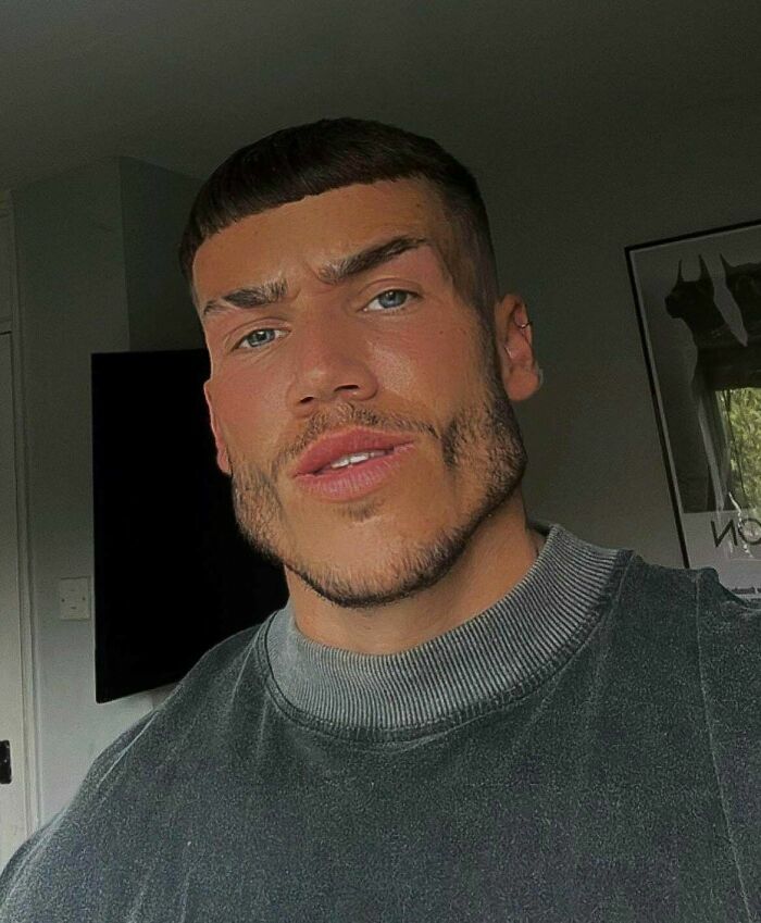 Retrato de hombre con mandíbula marcadamente modificada, mostrando el efecto de fotos tan retocadas.