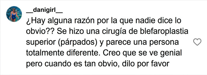 Comentario en redes sociales que especula sobre una cirug&iacute;a pl&aacute;stica de Jennifer Lawrence
