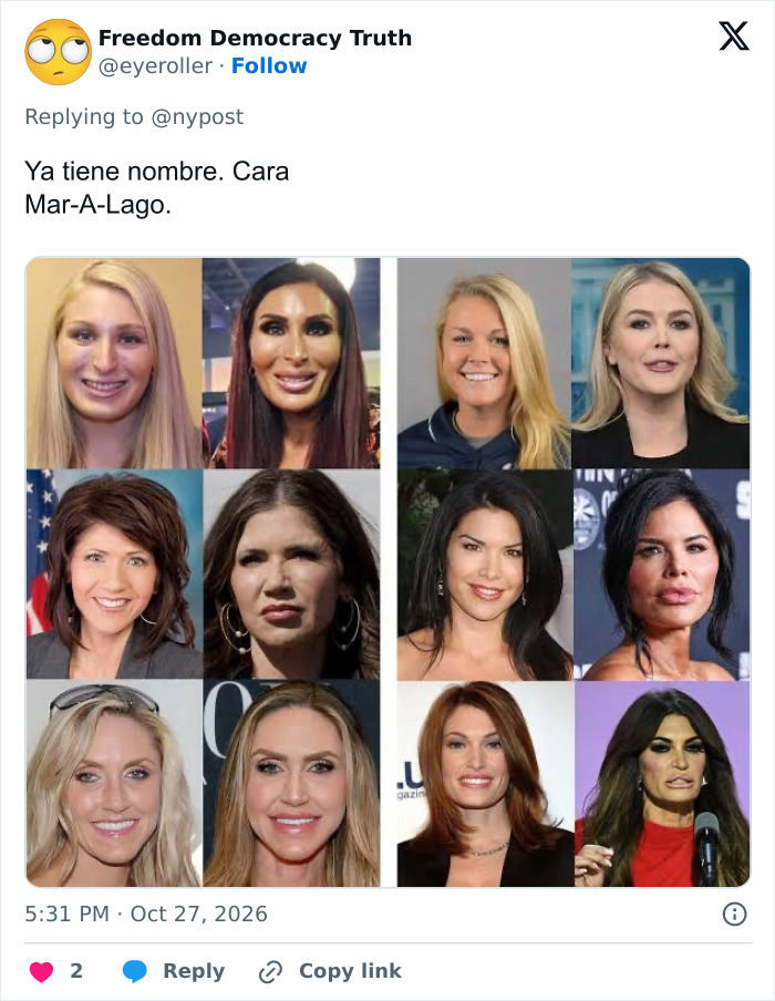 Tweet con im&aacute;genes del antes y despu&eacute;s de famosas con cirug&iacute;a pl&aacute;stica en el rostro