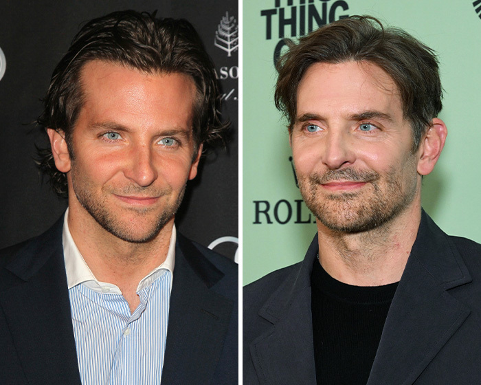 Imagen de Bradley Cooper en un antes y después sobre retoques como la blefaroplastia