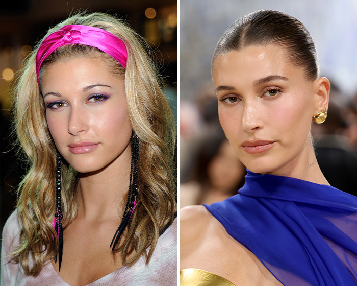 Antes y después de Hailey Bieber con posible blefaroplastia y cambio en la mirada.