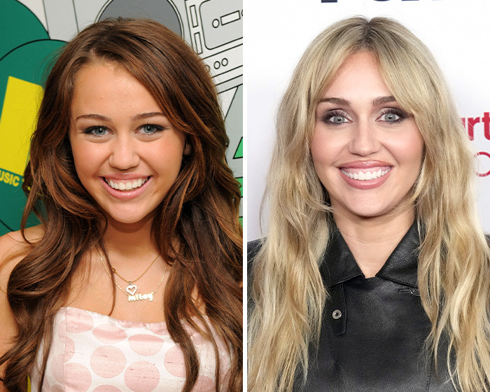 Miley Cyrus mostrando la evolución de sus ojos y sospechas de blefaroplastia.