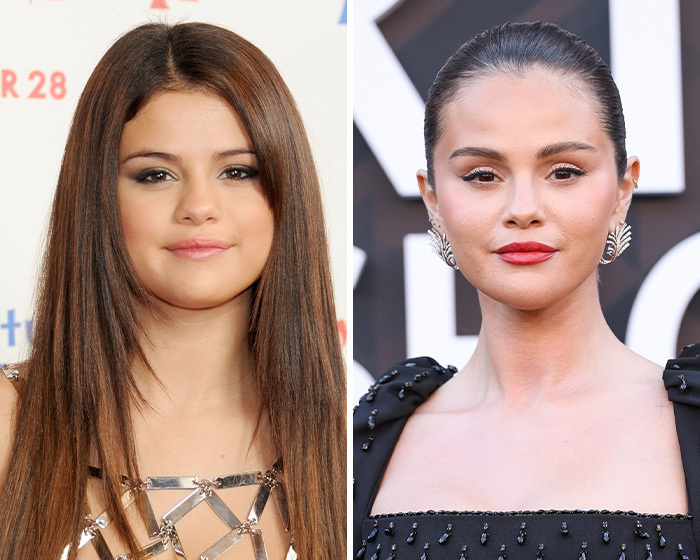 Comparación de Selena Gomez antes y después mostrando su posible blefaroplastia