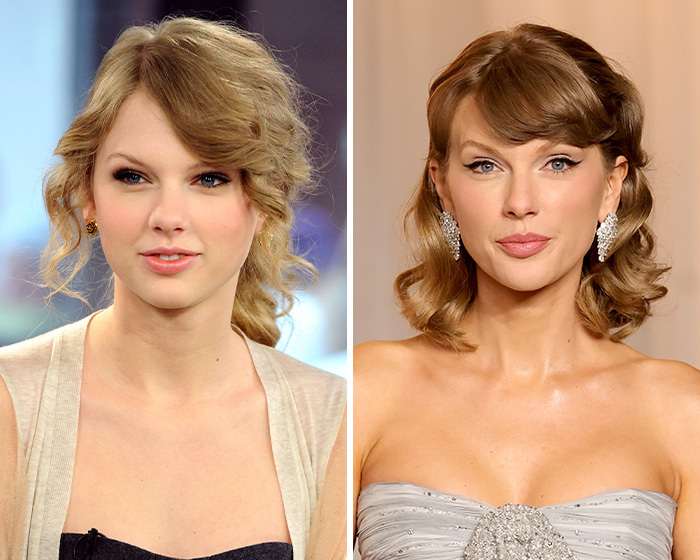 Fotografía del antes y después de Taylor Swift analizando una posible blefaroplastia